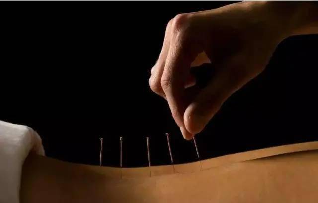 平衡針灸最新視頻，現代應用探索針灸藝術(shù)的新境界