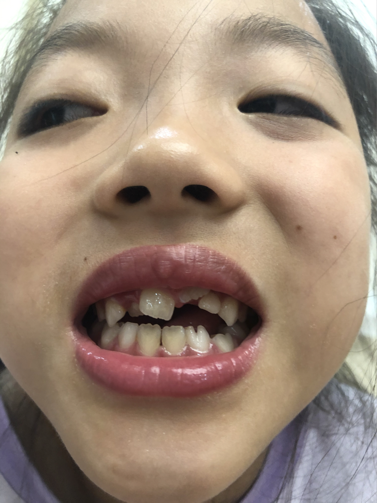 莊最新牙齒技術(shù)揭秘，牙齒美容新選擇